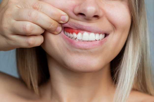 Причины появления черных пятен на зубах